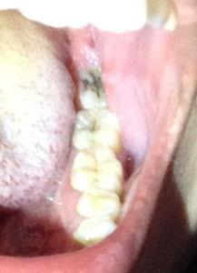 吃瓜嘴巴肿了,嘴巴肿成“香瓜”的尴尬经历