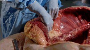 解剖吃瓜事件后续,揭秘背后真相与反思