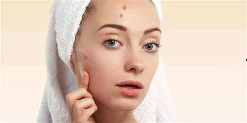 吃梨瓜长痘吗  第1张